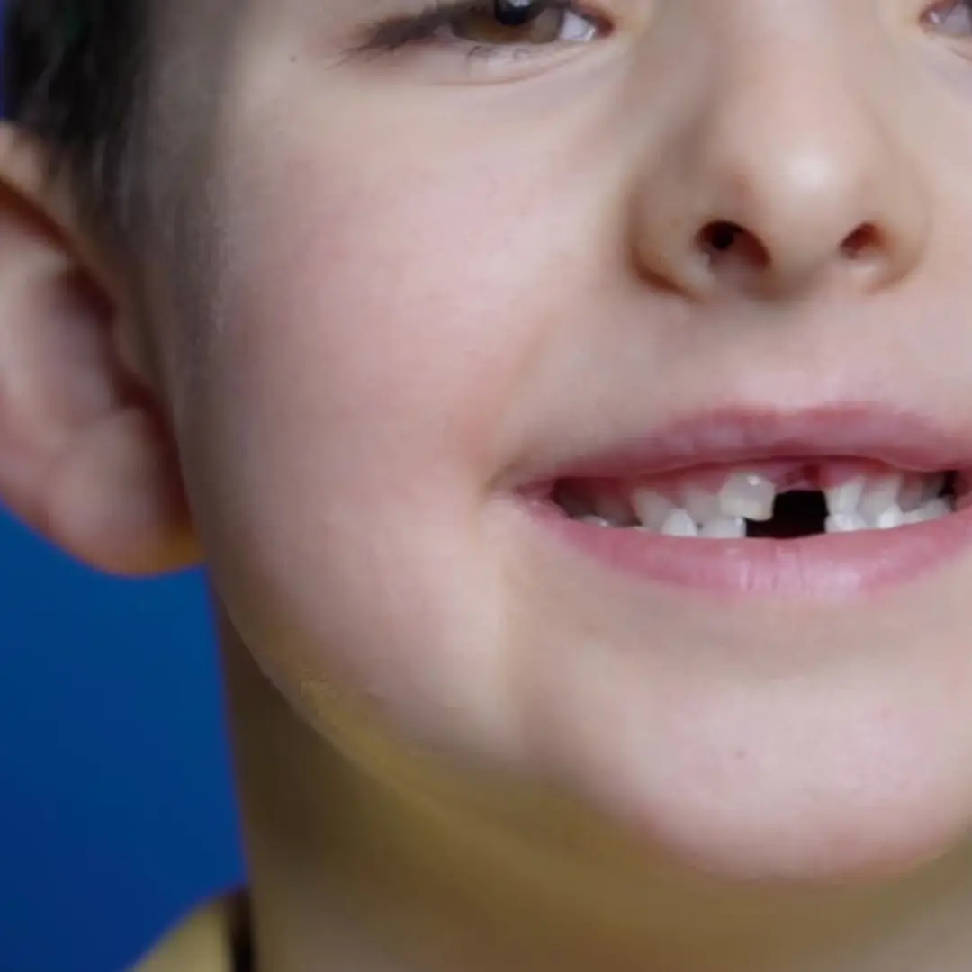 odontología para niños en ñuñoa