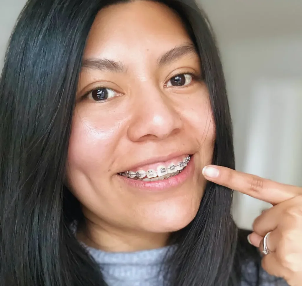 caso real de ortodoncia rápida