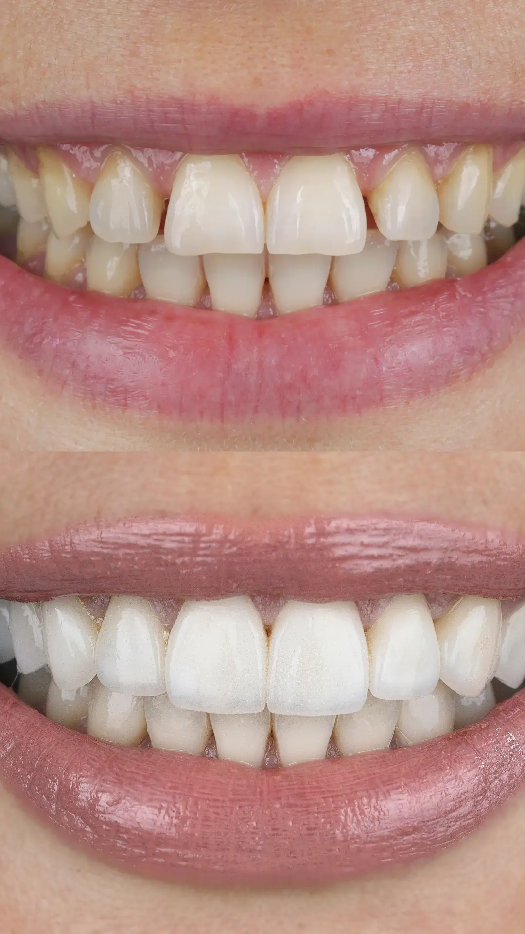 Paciente sonriendo post tratamiento