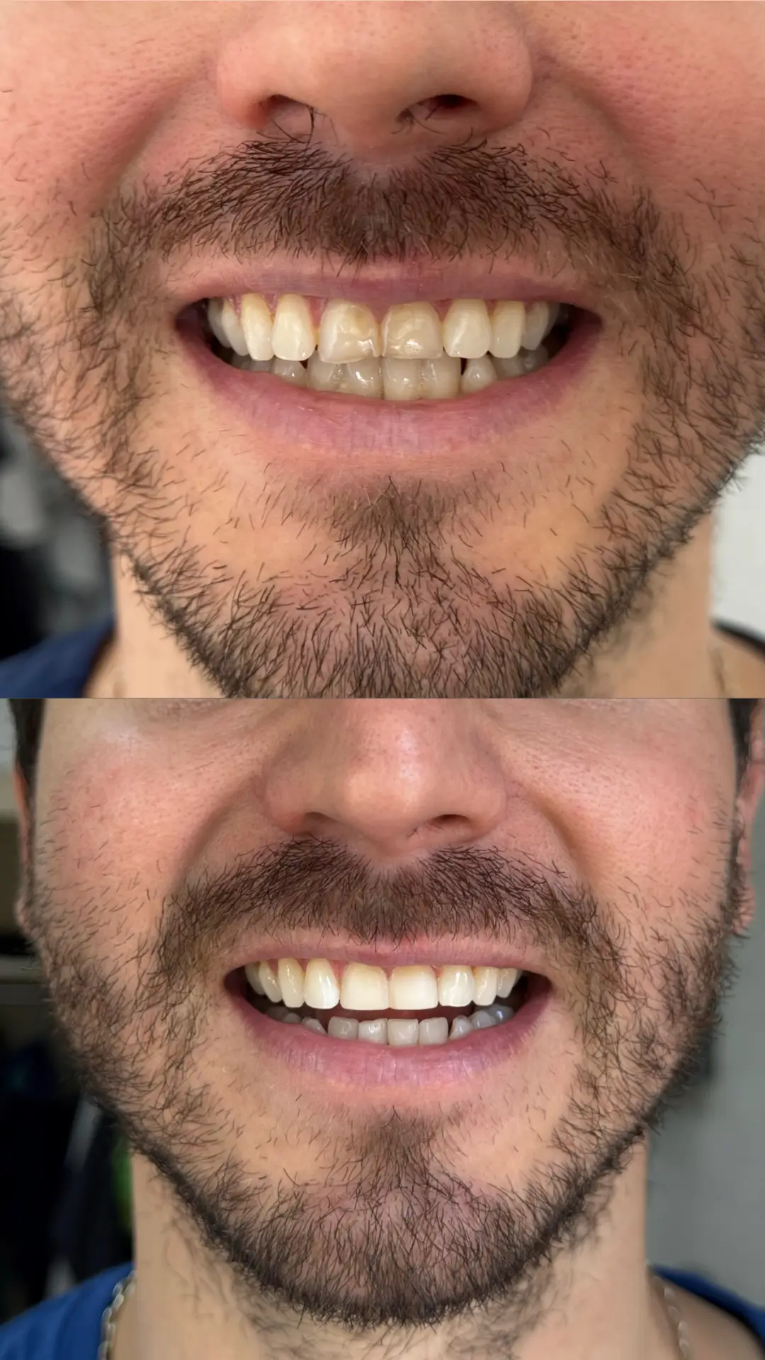 Evaluación de sonrisa con el especialista